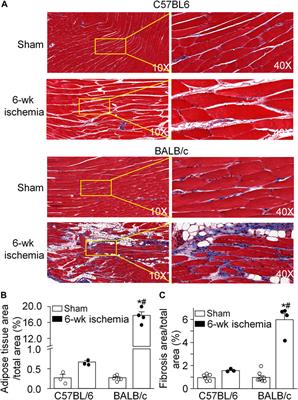 Different responses of skeletal muscles to femoral artery ligation-induced ischemia identified in BABL/c and C57BL/6 mice